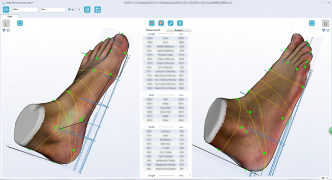 Обзор ортопедических 3D сканеров бренда ScanPod3D Обзор ортопедических 3D сканеров бренда ScanPod3D