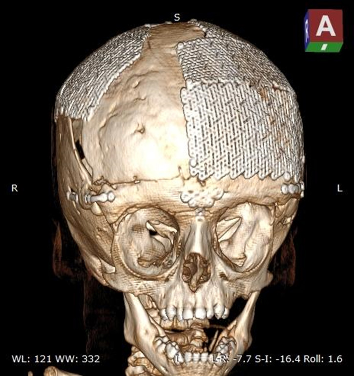 3D-печать в образовании