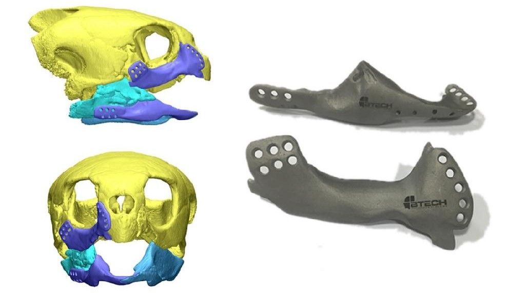 3D-модель протеза для Акут слева и готовый протез справа 3D модель протеза для Акут слева и готовый протез справа