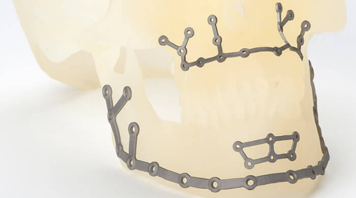 SLM-3D-принтеры-и-их-применение-5.jpg SLM-3D-принтеры-и-их-применение-5.jpg