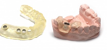 Фотополимерная смола HARZ Labs Dental Yellow Clear, прозрачный желтый (1000 гр)